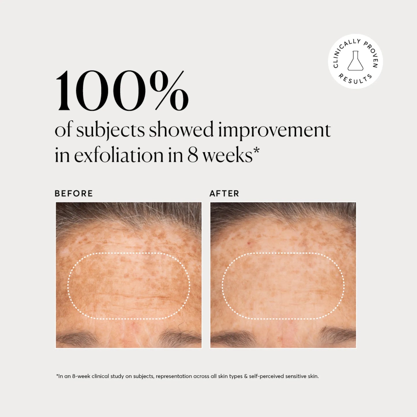 bha-liquid-exfoliant-2-l4 NATR-10027-Alt-Images-BHA-Liquid-Exfoliant-2_-03.webp